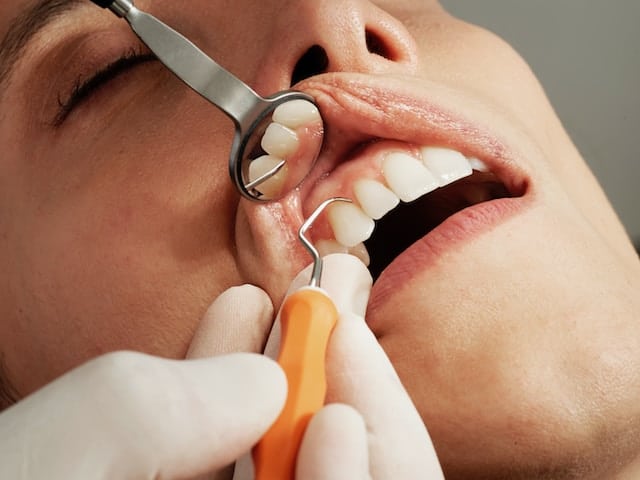 Jak zadbać o higienę jamy ustnej podczas noszenia aparatu ortodontycznego?