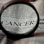 Czerniak - najgroźniejszy nowotwór skóry: przyczyny objawy i skuteczne metody leczenia