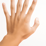 Przyczyny i skuteczne sposoby leczenia krost na dłoniach - poradnik
